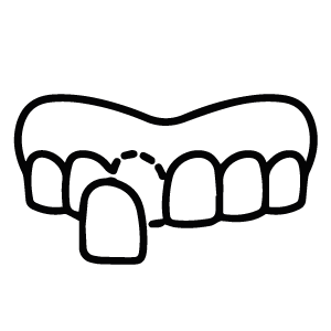 Crowns