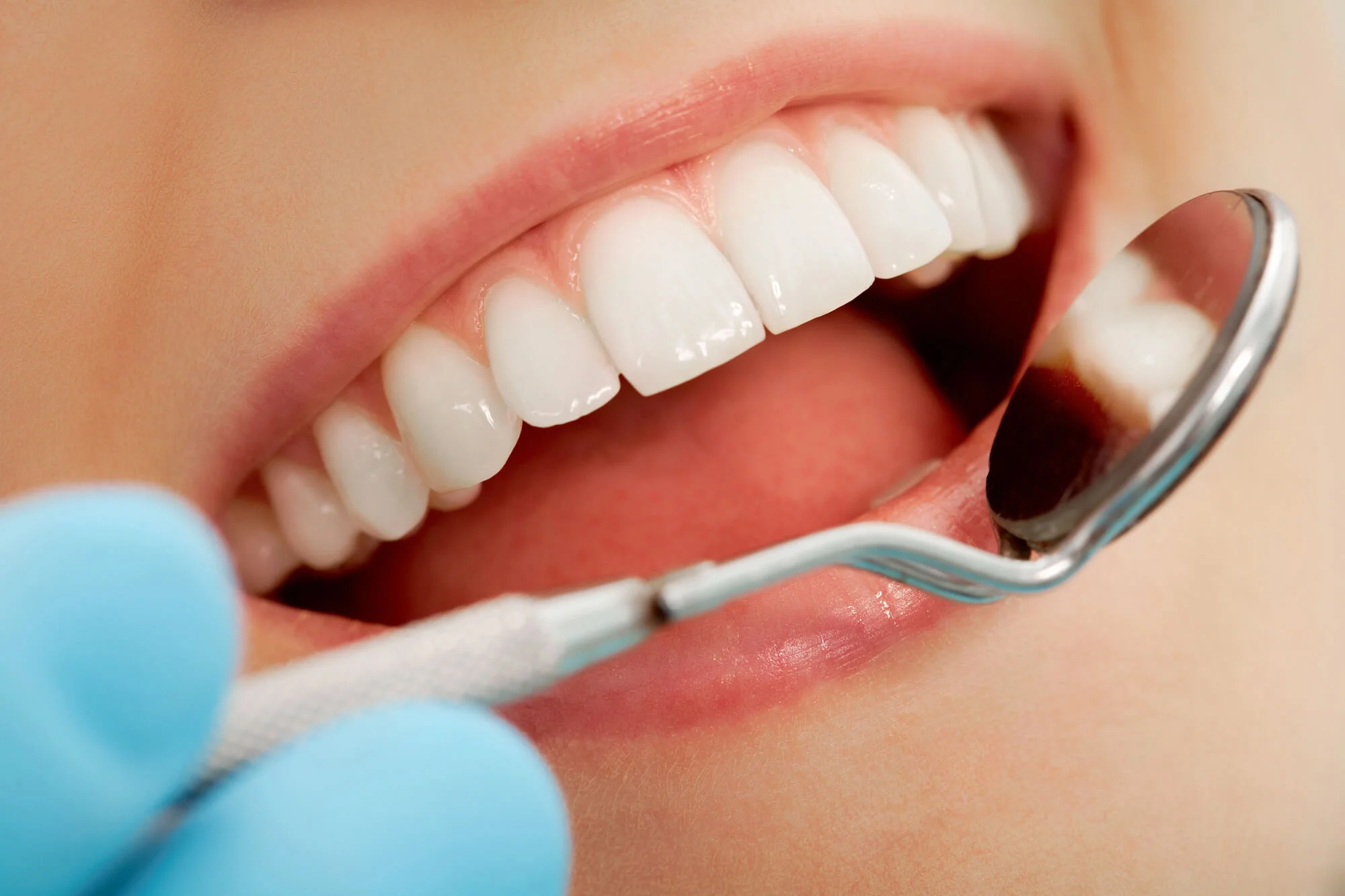 Close-up-Before-after-cosmetic-dentistry-in-NYC