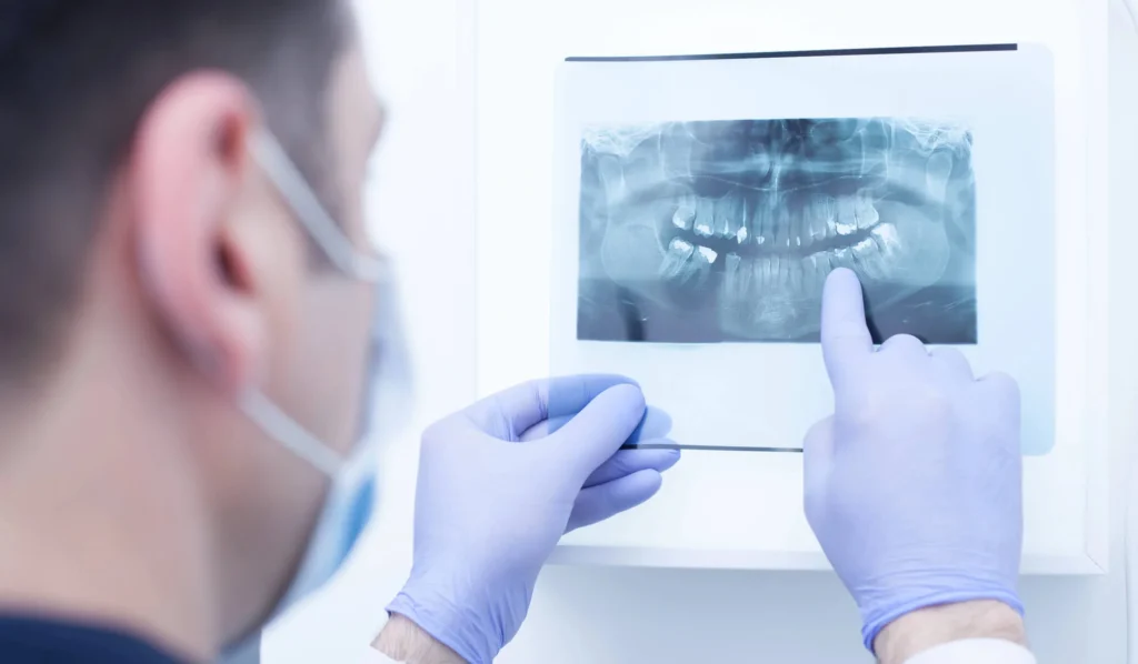 dentist-in-Upper-East-Side-reviewing-dental-X-ray