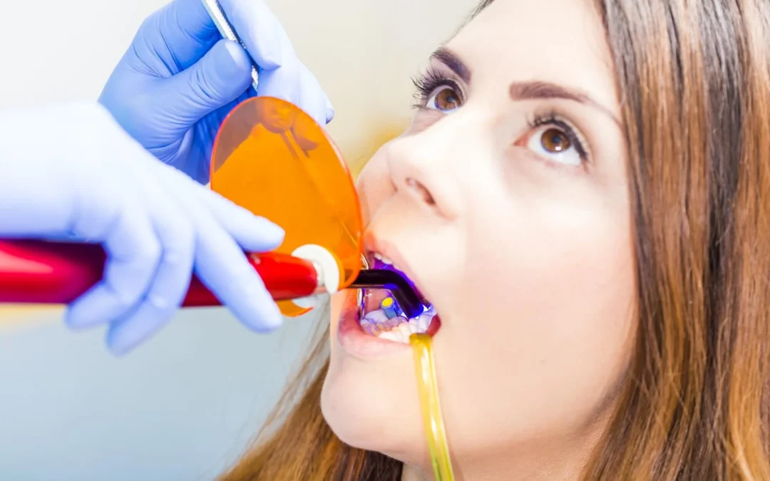 Dental Trauma Tips Before Seeing an Emergency Dentist in the Upper East Side 