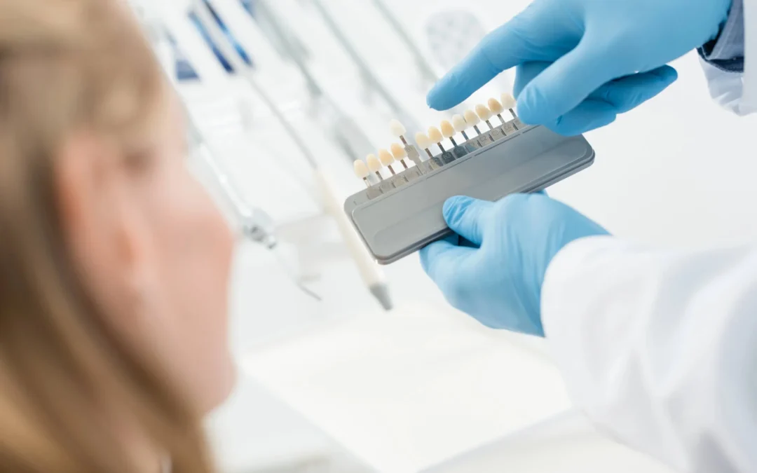 shade-match-dental-implants-Upper-East-Side